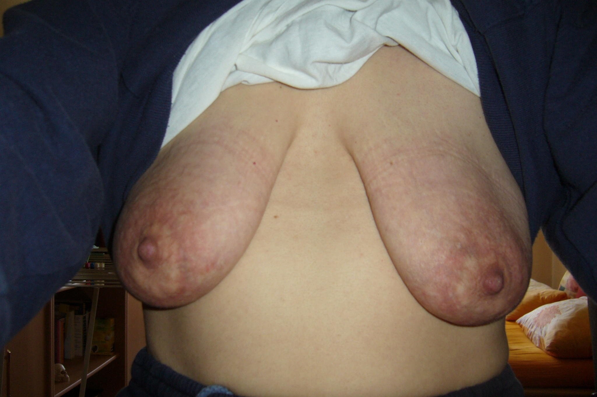 уродливая грудь порно фото 9