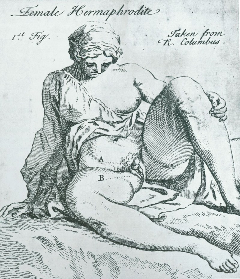 Влагалище транссексуала