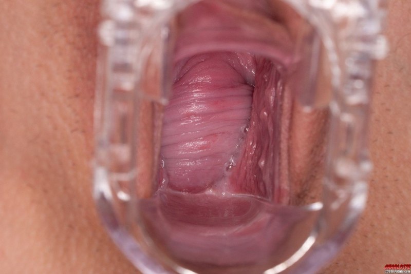 3d XRAY оплодотворение urethra