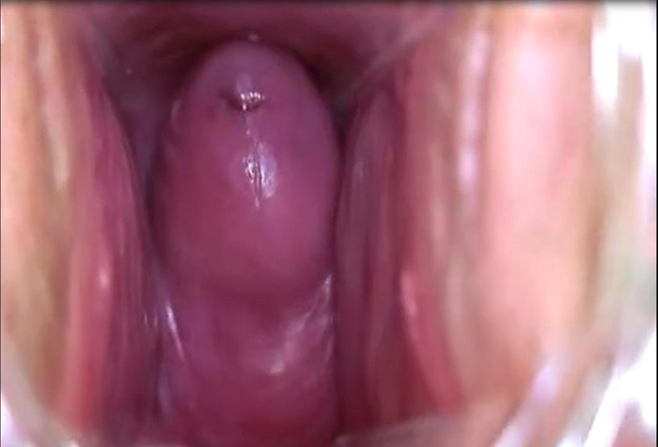 камеры во влагалище во время оргазма фото 1